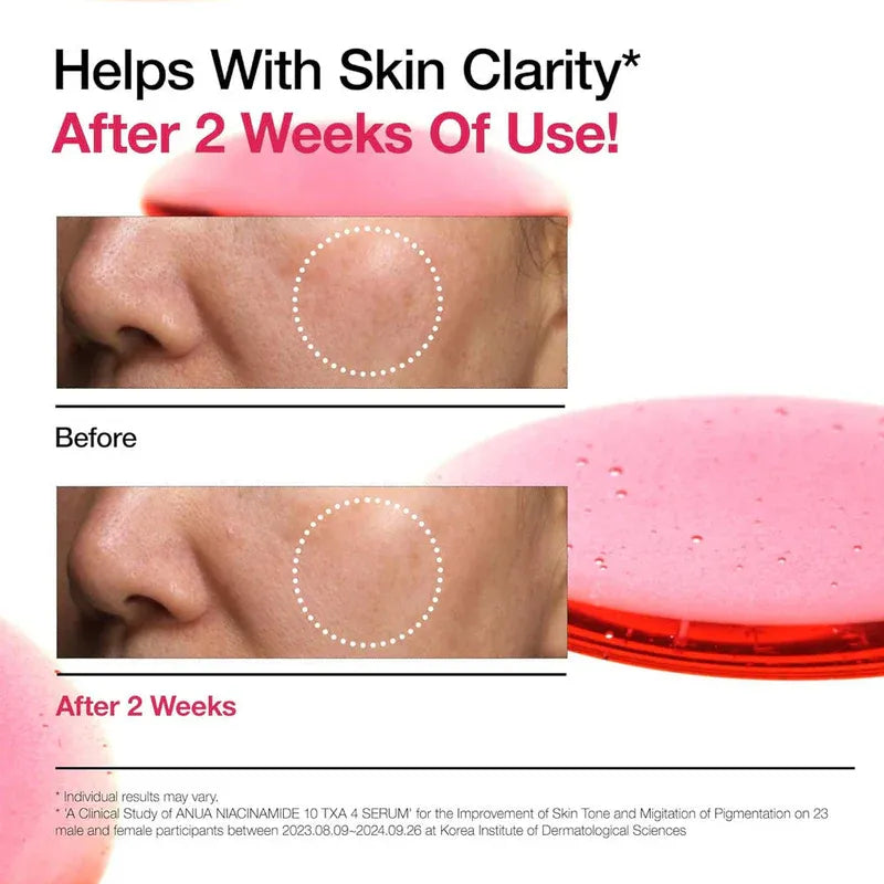 Anua Niacinamide 10% + TXA 4% Dark Spot Correcting Serum