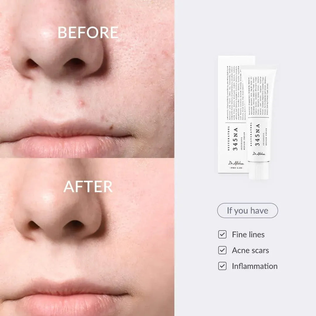 Before and after comparison of a face with acne scars, showing a product labeled 'Dr. Dennis' on the side.